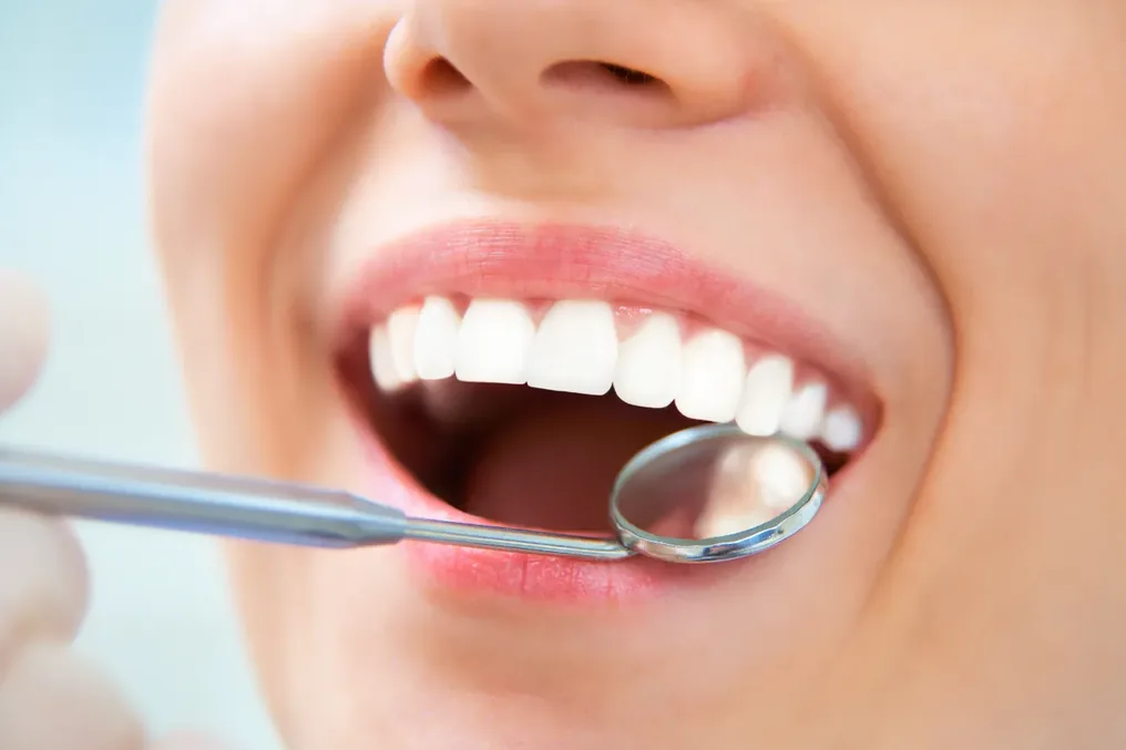 Igienizare dentară profesională la Smile Design București