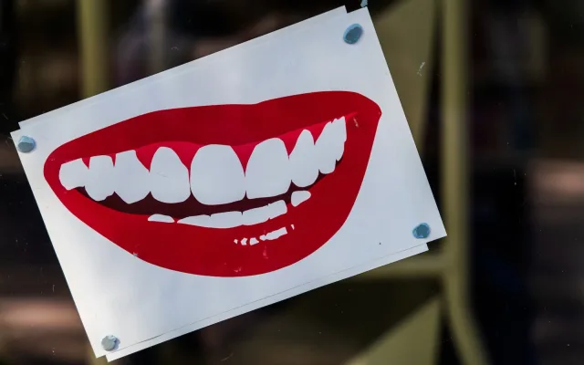 Albire dentară — tratament la clinica Smile Design București
