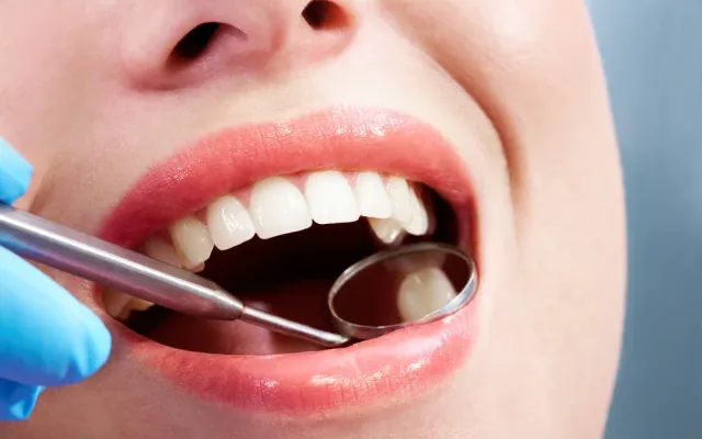 Igienizare dentară — tratament la clinica Smile Design București